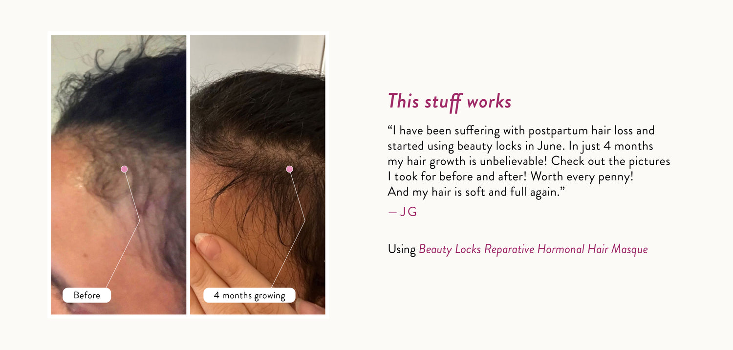 JG says, "I have been suffering with postpartum hair loss and started using beauty locks in June. In just 4 months my hair growth is unbelievable! Check out the pictures I took for before and after! Worth every penny! And my hair is soft and full again!."