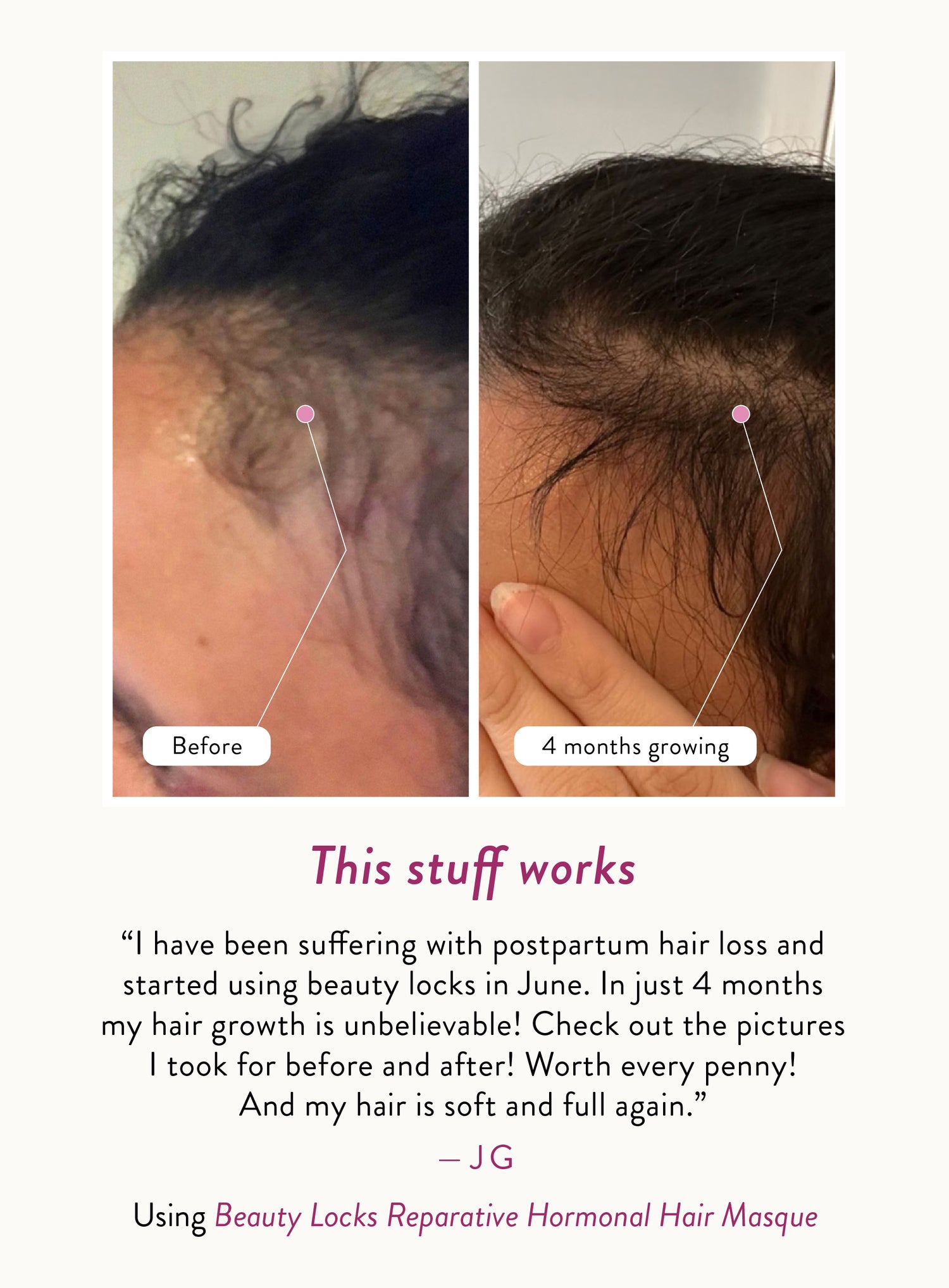 JG says, "I have been suffering with postpartum hair loss and started using beauty locks in June. In just 4 months my hair growth is unbelievable! Check out the pictures I took for before and after! Worth every penny! And my hair is soft and full again!."