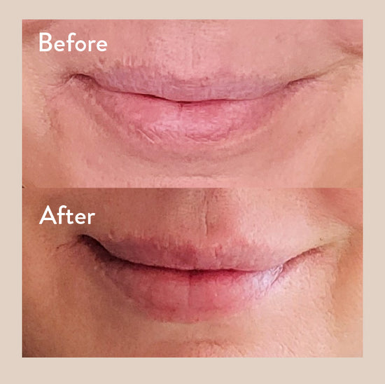 Before and after photos of a 2nd customer's lips